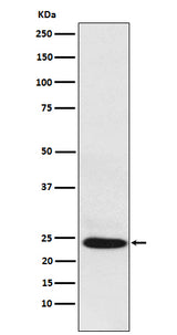 Anti-BAG2 Rabbit Monoclonal Antibody Boster Bio
