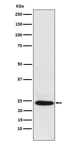 Anti-BAG2 Rabbit Monoclonal Antibody Boster Bio