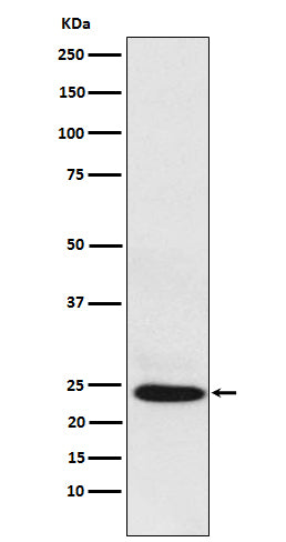 Anti-BAG2 Rabbit Monoclonal Antibody Boster Bio