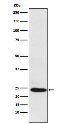 Anti-BAG2 Rabbit Monoclonal Antibody Boster Bio