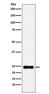Anti-BAG2 Monoclonal Antibody Boster Bio