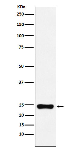 Anti-BAG2 Monoclonal Antibody Boster Bio