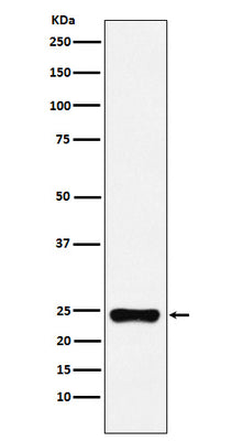 Anti-BAG2 Monoclonal Antibody Boster Bio