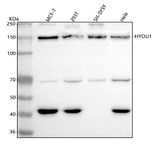 Anti-ORP150 Rabbit Monoclonal Antibody Boster Bio