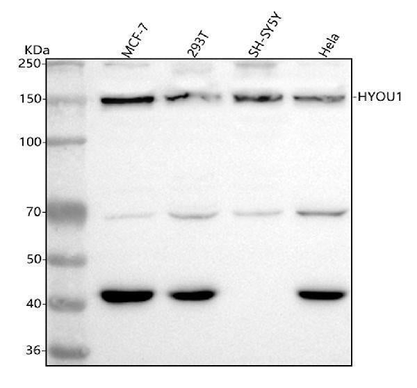 Anti-ORP150 Rabbit Monoclonal Antibody Boster Bio
