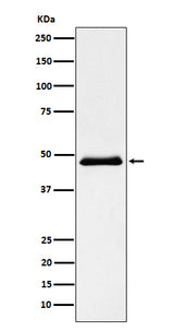 Anti-Pancreatic Lipase （PNLIP） Rabbit Monoclonal Antibody Boster Bio