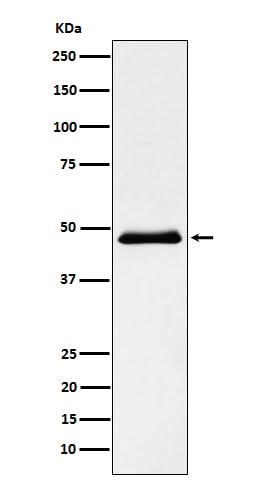 Anti-Pancreatic Lipase （PNLIP） Rabbit Monoclonal Antibody Boster Bio