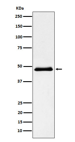 Anti-Pancreatic Lipase （PNLIP） Rabbit Monoclonal Antibody Boster Bio