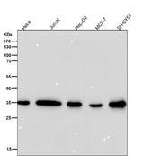 Anti-FRG1 Rabbit Monoclonal Antibody Boster Bio