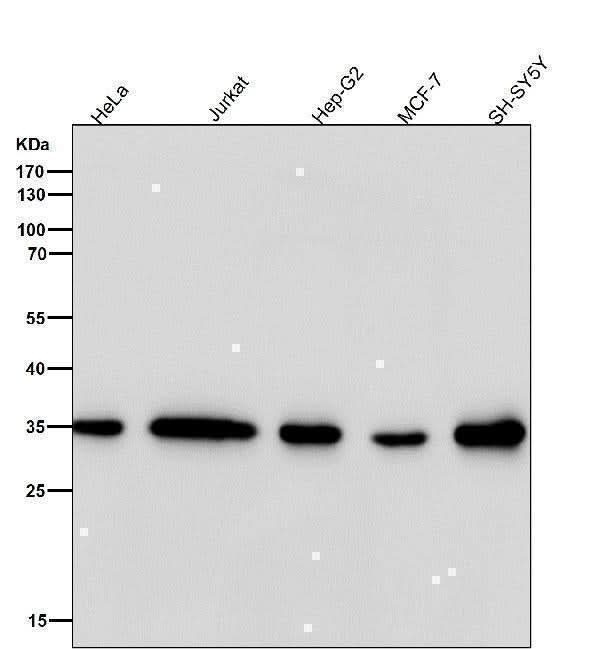 Anti-FRG1 Rabbit Monoclonal Antibody Boster Bio