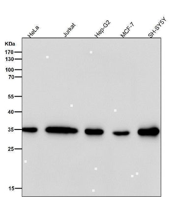Anti-FRG1 Rabbit Monoclonal Antibody Boster Bio