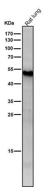 Anti-ATF7 Rabbit Monoclonal Antibody Boster Bio