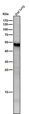 Anti-ATF7 Rabbit Monoclonal Antibody Boster Bio