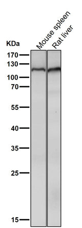 Anti-Mov10 Rabbit Monoclonal Antibody Boster Bio