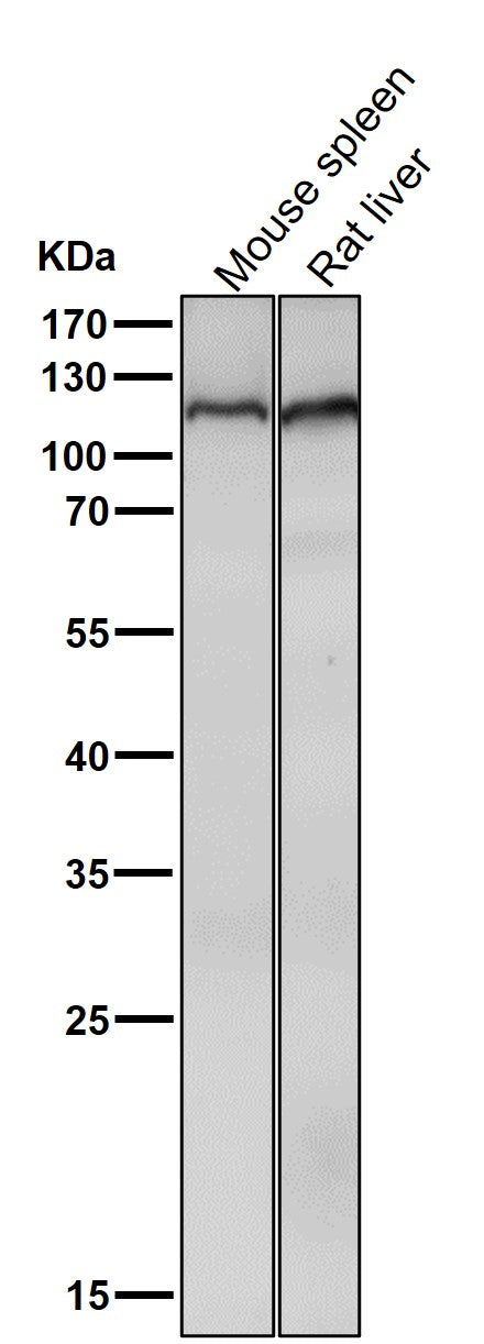 Anti-Mov10 Rabbit Monoclonal Antibody Boster Bio