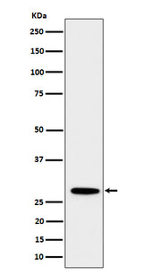 Anti-PSMB10 Rabbit Monoclonal Antibody Boster Bio