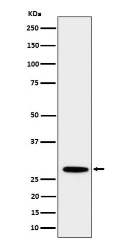 Anti-PSMB10 Rabbit Monoclonal Antibody Boster Bio