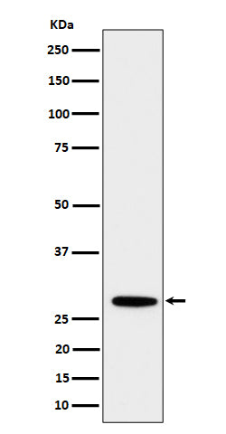 Anti-PSMB10 Rabbit Monoclonal Antibody Boster Bio