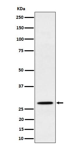 Anti-PSMB10 Rabbit Monoclonal Antibody Boster Bio