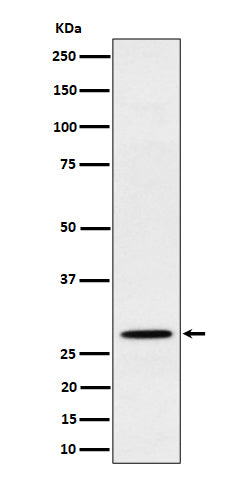 Anti-PSMB10 Rabbit Monoclonal Antibody Boster Bio
