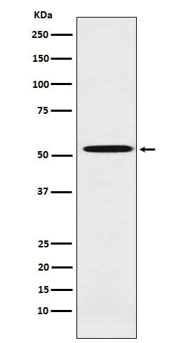 Anti-ALDH1A2 Rabbit Monoclonal Antibody Boster Bio