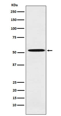 Anti-ALDH1A2 Rabbit Monoclonal Antibody Boster Bio