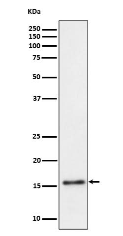 Anti-TRAPPC2 Rabbit Monoclonal Antibody Boster Bio