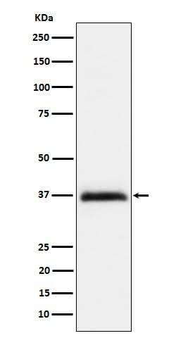 Anti-RGMA Rabbit Monoclonal Antibody Boster Bio