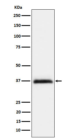 Anti-RGMA Rabbit Monoclonal Antibody Boster Bio