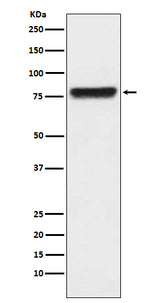 Anti-KLKB1 Monoclonal Antibody Boster Bio