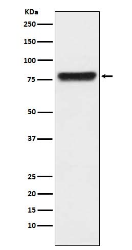Anti-KLKB1 Monoclonal Antibody Boster Bio