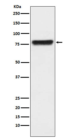 Anti-KLKB1 Monoclonal Antibody Boster Bio