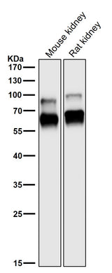 Anti-CRMP1 Rabbit Monoclonal Antibody Boster Bio