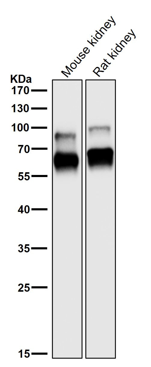 Anti-CRMP1 Rabbit Monoclonal Antibody Boster Bio