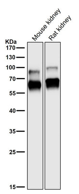 Anti-CRMP1 Rabbit Monoclonal Antibody Boster Bio
