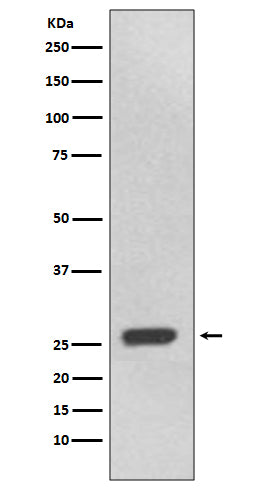 Anti-UCHL3 Rabbit Monoclonal Antibody Boster Bio