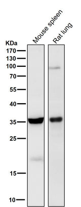 Anti-5HT7 Receptor Rabbit Monoclonal Antibody Boster Bio
