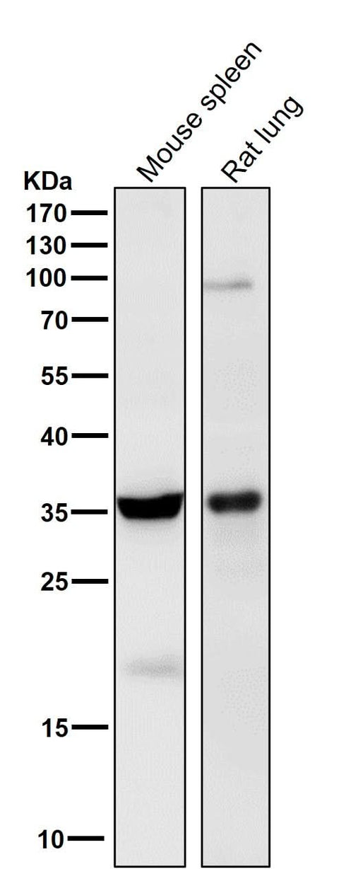 Anti-5HT7 Receptor Rabbit Monoclonal Antibody Boster Bio