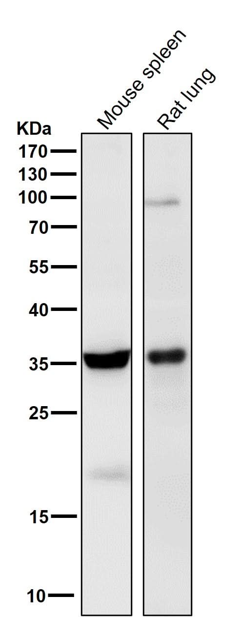 Anti-5HT7 Receptor Rabbit Monoclonal Antibody Boster Bio
