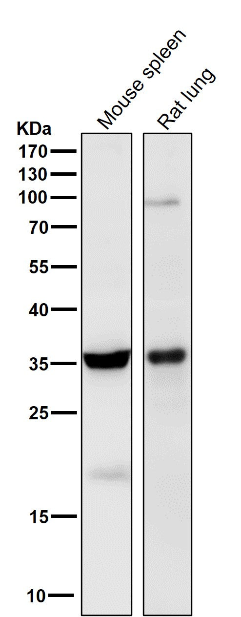 Anti-5HT7 Receptor Rabbit Monoclonal Antibody Boster Bio