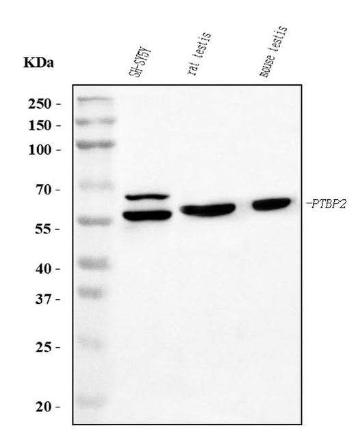 Anti-PTBP2 Picoband® Antibody (monoclonal, 13D11 Boster Bio