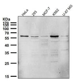 Anti-PTBP2 Rabbit Monoclonal Antibody Boster Bio