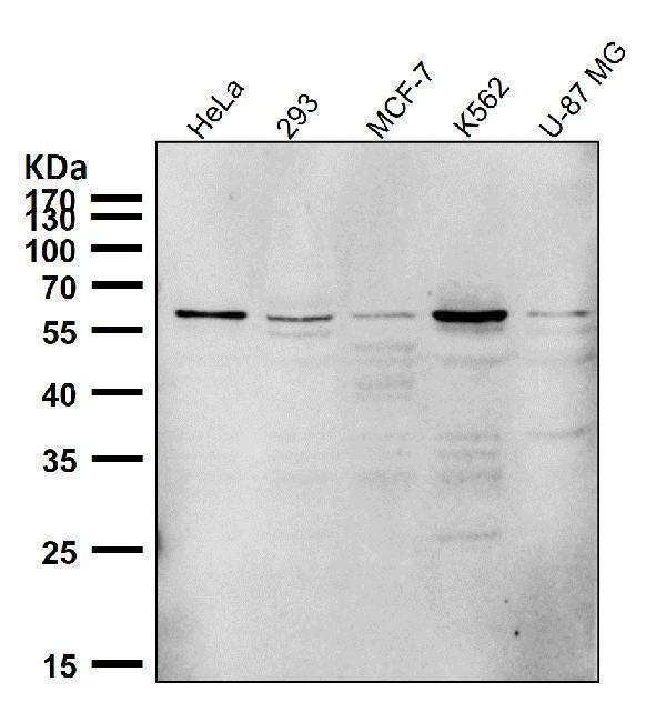 Anti-PTBP2 Rabbit Monoclonal Antibody Boster Bio