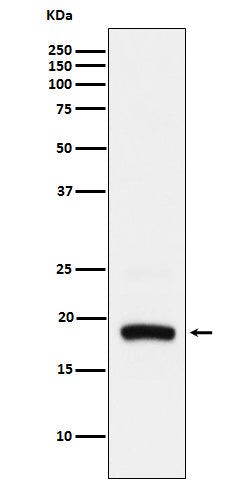 Anti-ARF5 Rabbit Monoclonal Antibody Boster Bio
