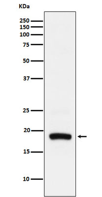 Anti-ARF5 Rabbit Monoclonal Antibody Boster Bio