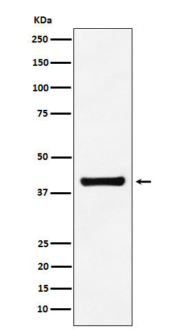 Anti-Aldolase ALDOA Monoclonal Antibody Boster Bio