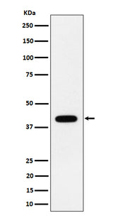 Anti-ACADS / SCAD Rabbit Monoclonal Antibody Boster Bio
