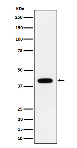 Anti-ACADS / SCAD Rabbit Monoclonal Antibody Boster Bio