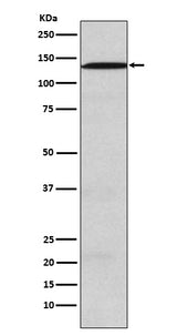 Anti-USP28 Rabbit Monoclonal Antibody Boster Bio