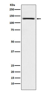 Anti-USP28 Monoclonal Antibody Boster Bio
